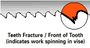 Teeth Fracture Front of tooth